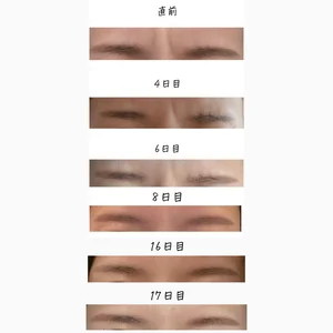 チャプター添付画像